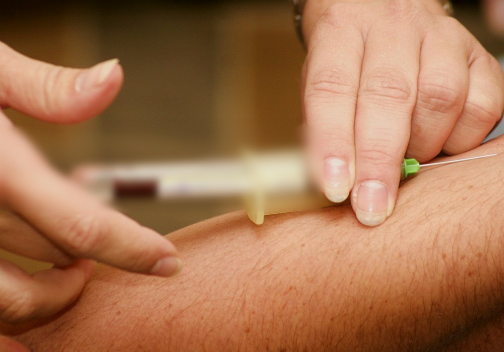 Why Regular Health Screenings Matter